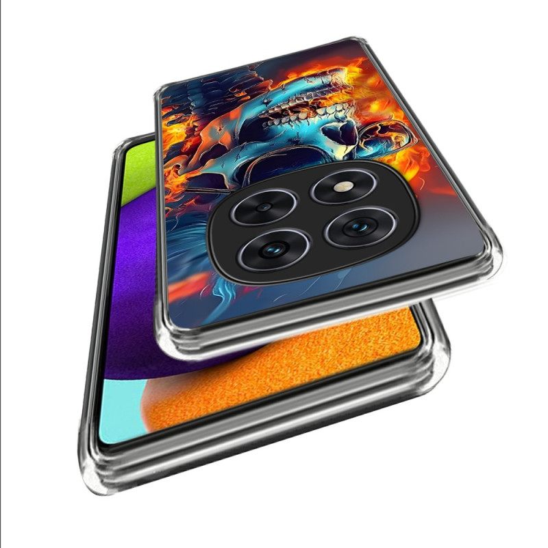 Κάλυμμα Xiaomi Redmi Note 14 Pro 4g Φλεγόμενο Κρανίο