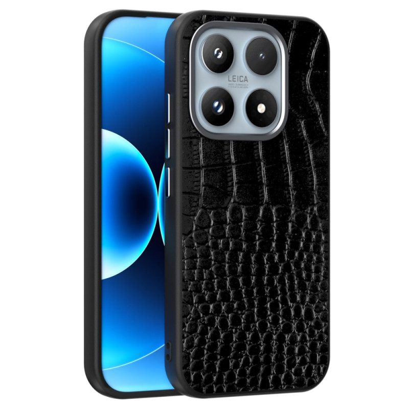 Κάλυμμα Xiaomi 17 Magsafe Εφέ Κροκόδειλου Abeel